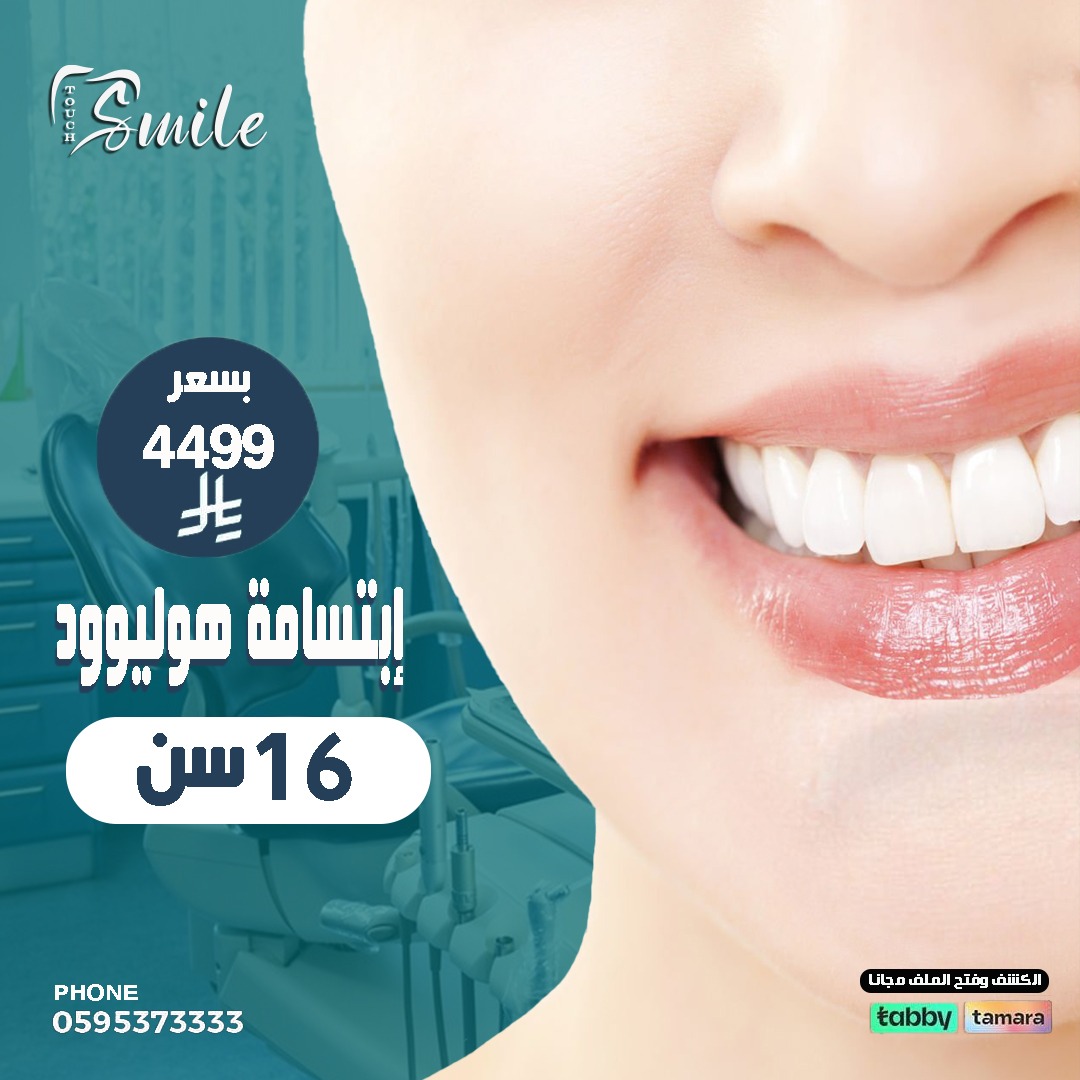 لمسة الأبتسامة